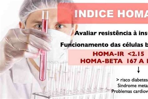 indice homa-1
